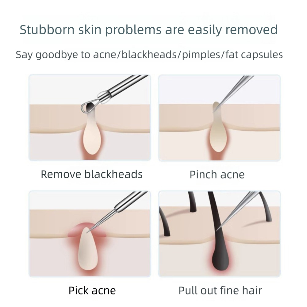 3-5 adet Batık Saç Cımbız Akne - Hair Care Clinic incelemesi ve fiyatı